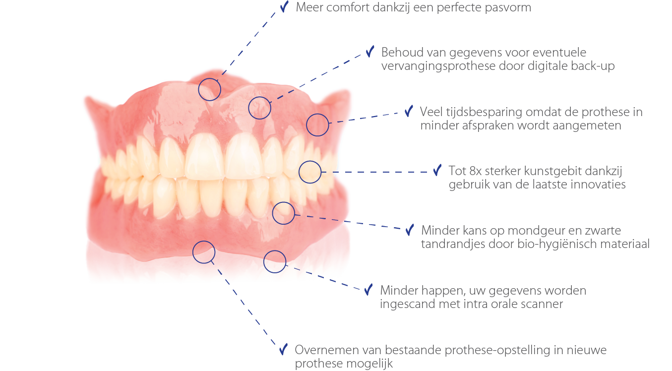 identificatie Ook Kan worden berekend AvaDent 3D Kunstgebit - Digitale Prothese - Tandheelkunde Oss